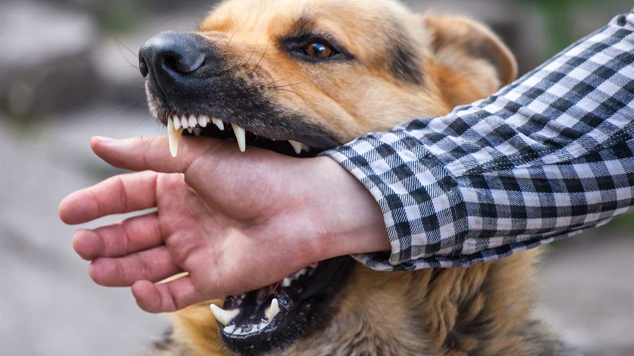 Best Dog Bite Injury Attorney